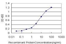 GATB / PET112 Antibody (clone 6B2)