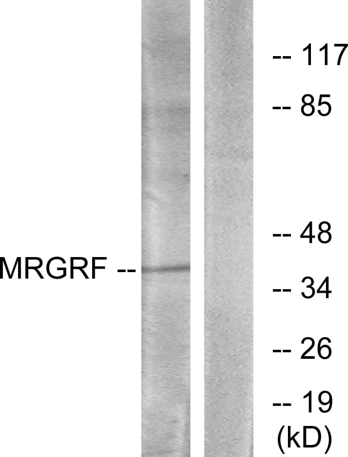 MRGPRF Antibody (aa271-320)