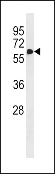 NAPRT Antibody (aa74-100)