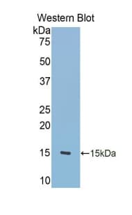 TNC / Tenascin C Antibody (aa513-621, PE)