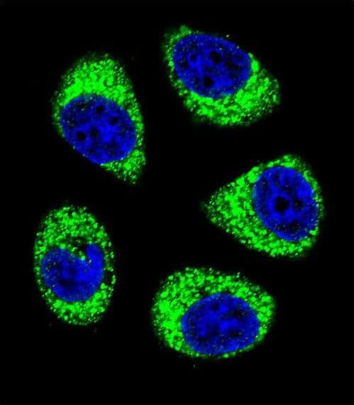 IHC-plus™ SLC25A6 / ANT3 Antibody (aa128-155)