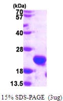 Human HSPB11 Protein (Recombinant His)