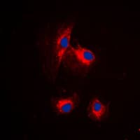 MRPL15 Antibody (Internal)