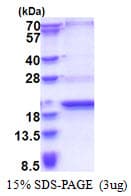 Human SCP2D1 / C20orf79 Protein (Recombinant His)