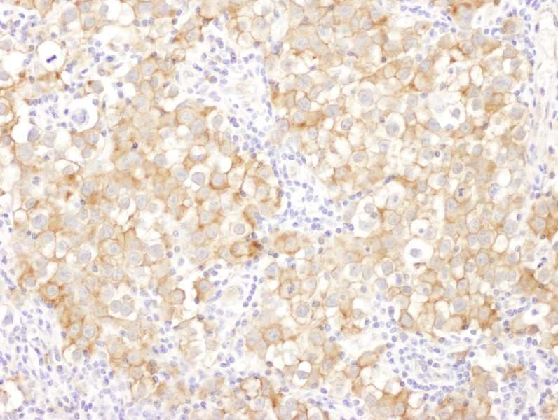 DBN1 / Drebrin Antibody (aa599-649)