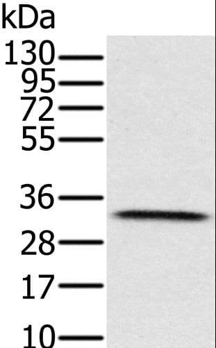 IHC-plus™ HSD17B8 / RING2 Antibody