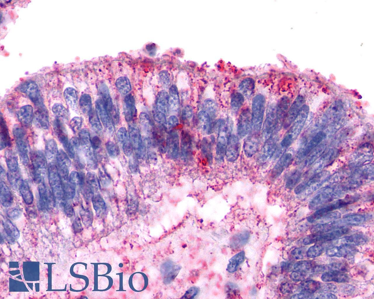 Polyclonal Rabbit anti-Human AVPR2 / V2R Antibody (Cytoplasmic Domain, IHC)