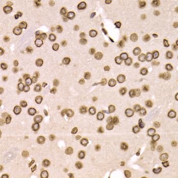 LAMB2 / Laminin Beta 2 Antibody