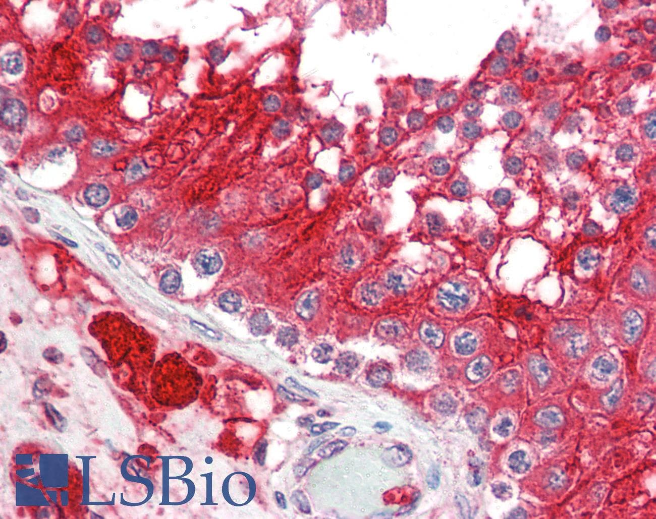 PathPlus™ Polyclonal Rabbit anti-Human ACE2 / ACE-2 Antibody (IHC, IF, WB)