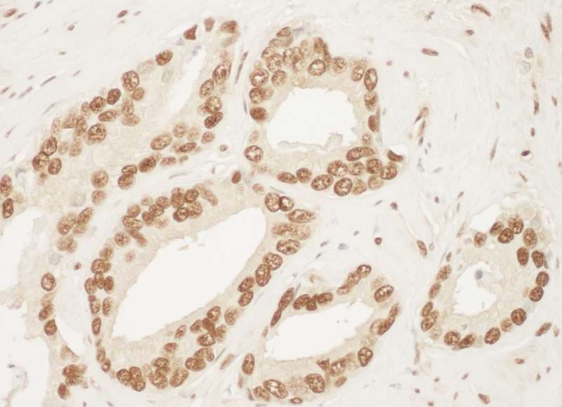 Polyclonal Rabbit anti-Human XRCC6 / Ku70 Antibody (aa559-609, IHC, WB)