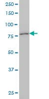 Monoclonal Mouse anti-Human KCNC3 / Kv3.3 Antibody (clone 1C1, IF, WB)