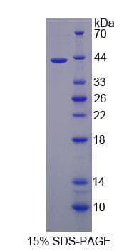 Human BRP44L Protein (Recombinant His-S)