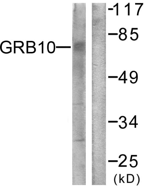 GRB10 Antibody (p67)