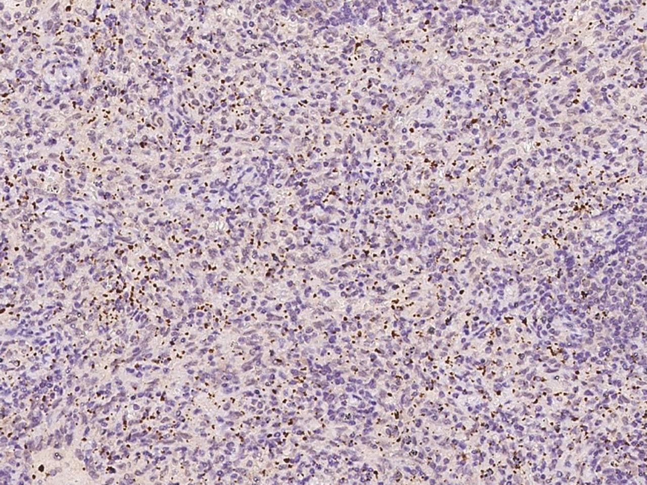 TREML1 / TLT1 Antibody