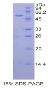 Human WNT10A Protein (Recombinant His, N-Terminal)