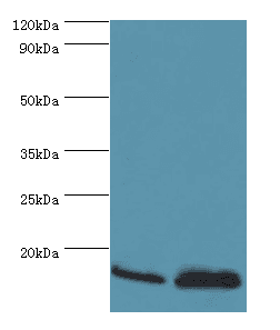 ATP5J Antibody (aa1-108)