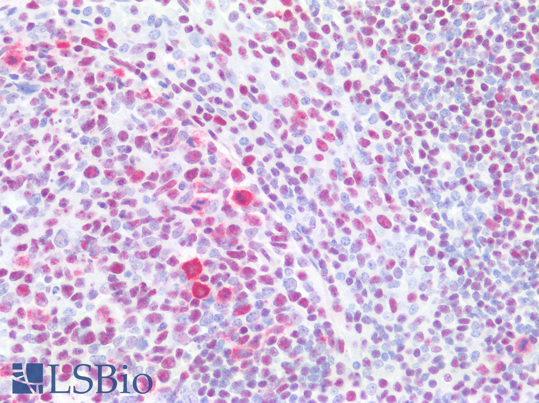 PathPlus™ Polyclonal Rabbit anti-Human CDK1 / CDC2 Antibody (aa121-170, IHC, WB)