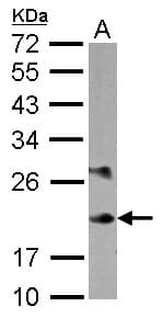 MYL6B Antibody