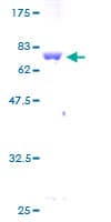 Human KRT33B / Keratin 33B / KRTHA3B Protein (Recombinant GST)