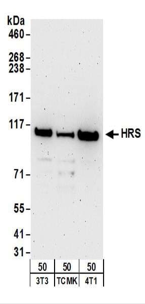 Polyclonal Rabbit anti-Human HRS / HGS Antibody (aa727-C-term, WB)