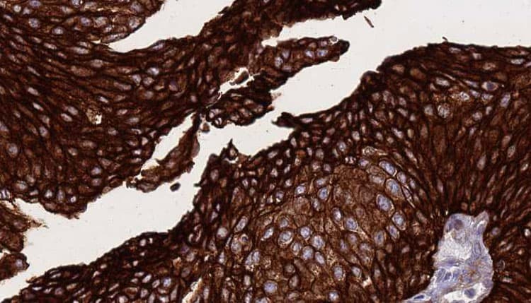 Polyclonal Rabbit anti-Human CD71 / Transferrin Receptor Antibody (IHC, IF, WB)
