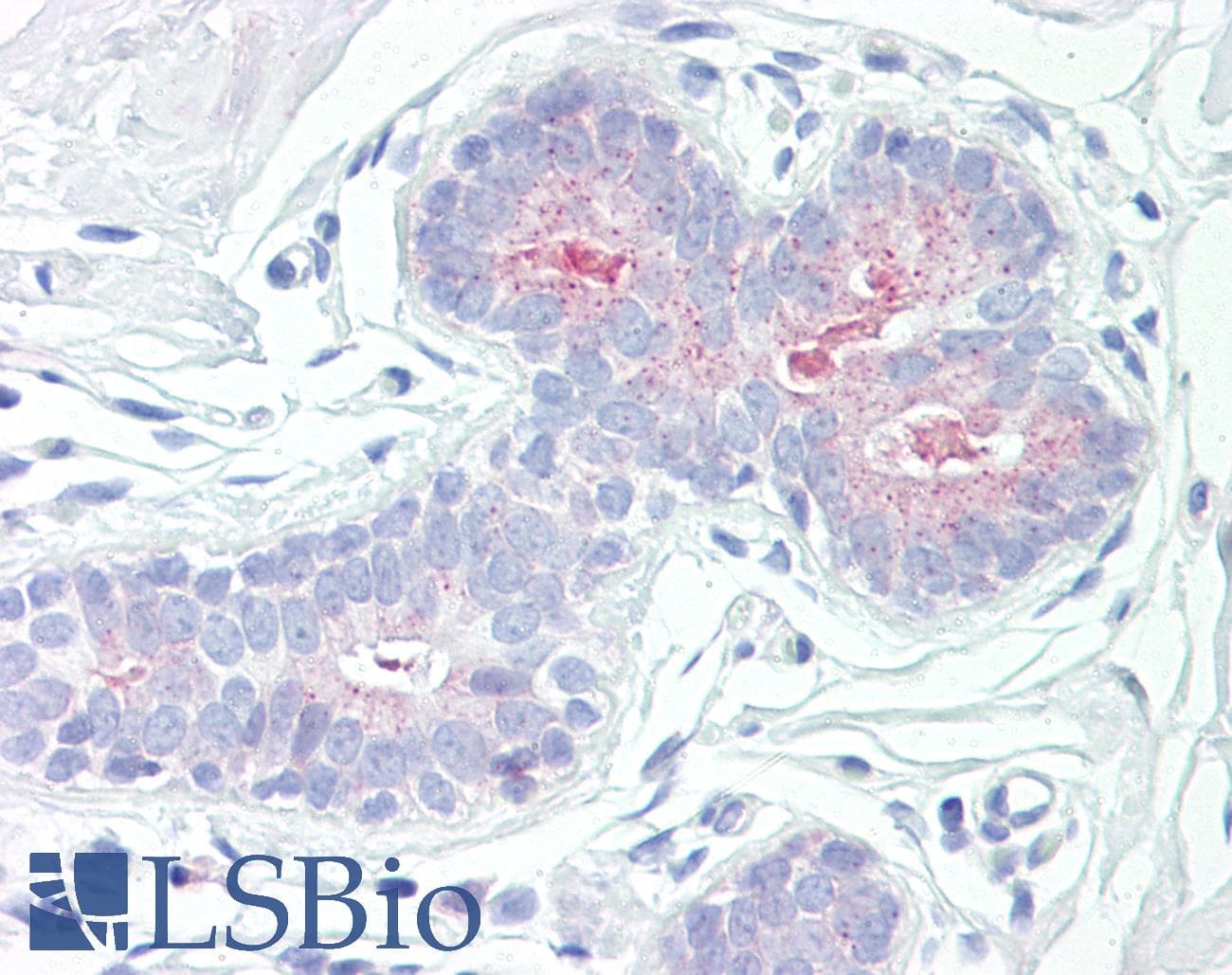 IHC-plus™ RPS6KB1 / P70S6K / S6K Antibody (aa393-442)