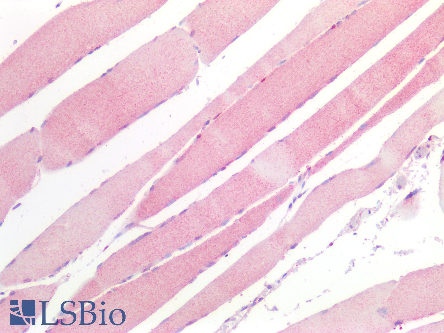 PathPlus™ HDAC4 Antibody
