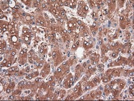 Monoclonal Mouse anti-Human CPA1 / Carboxypeptidase A Antibody (clone OTI2A3, IHC, IF, WB)