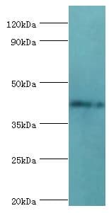TDG / Thymine DNA Glycosylase Antibody (aa141-410)