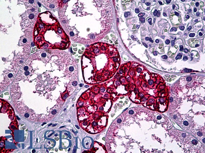 IHC-plus™ EPCAM Antibody (clone VU-1D9)