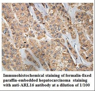 Polyclonal Rabbit anti-Human ARL16 Antibody (aa19-197, IHC, WB)