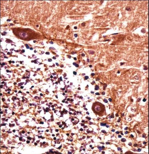 PJA1 / PRAJA1 Antibody (aa155-183)