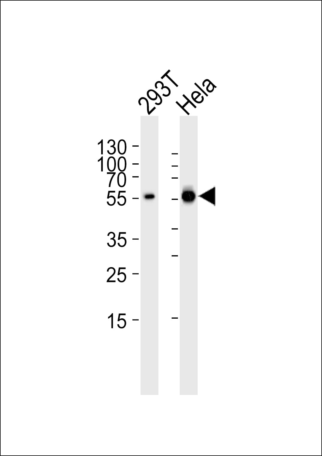 GLS / Glutaminase Antibody (aa516-545)