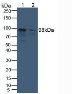 ACO1 / Aconitase Antibody (aa251-443, Biotin)