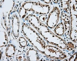 Monoclonal Mouse anti-Human ARNT / HIF-1-Beta Antibody (clone OTI1F4, IHC, IF, WB)