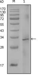 F8 / FVIII / Factor VIII Antibody (clone 5E9B2)