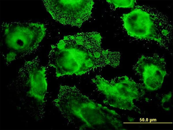 Monoclonal Mouse anti-Human MRPL12 Antibody (clone 3B12-1A3, IHC, IF, WB)
