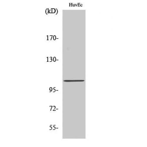 Polyclonal Rabbit anti-Human AGBL2 / CCP2 Antibody (700-780 aa, C-terminal, IHC, WB)