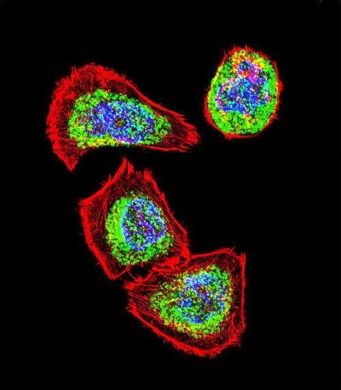 IHC-plus™ Polyclonal Rabbit anti-Human Vimentin Antibody (IHC, IF, WB)