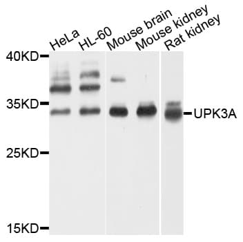 UPK3A / UPK3 / Uroplakin III Antibody (aa19-207)