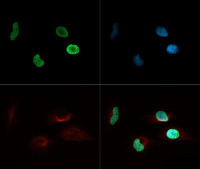 Polyclonal Rabbit anti-Human HIST4H4 Antibody (Ac-Lys8, IHC, IF, WB)