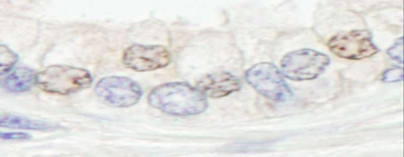 ERCC4 / XPF Antibody (aa855-905)