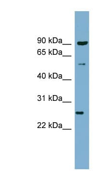 Polyclonal Rabbit anti-Human VAMP7 / SYBL1 / T1 VAMP Antibody (aa35-84, WB)