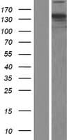 NCAPD2 Protein (Over-Expression Lysate Myc-DDK (Flag))