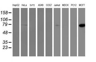 PFKP Antibody (clone OTI2E8, Carrier-free)