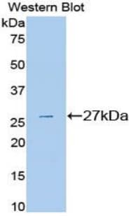 PLG / Plasmin / Plasminogen Antibody (aa582-812)