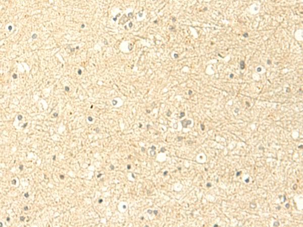 HsT19268 / MTHFS Antibody