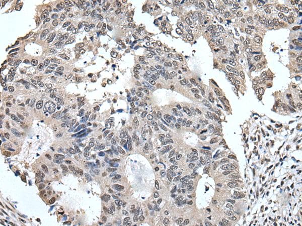 TRIM23 Antibody