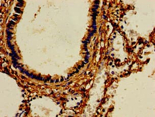 AOC3 / VAP-1 Antibody