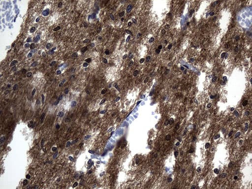 Monoclonal Mouse anti-Human MAPT / Tau Antibody (clone UMAB239, aa623-758, IHC, WB)